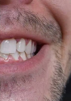 Gentle lift in surface stains over time.